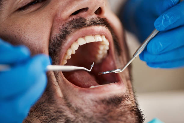 Best Emergency Dental Care for Broken or Chipped Teeth in Tremont, PA
